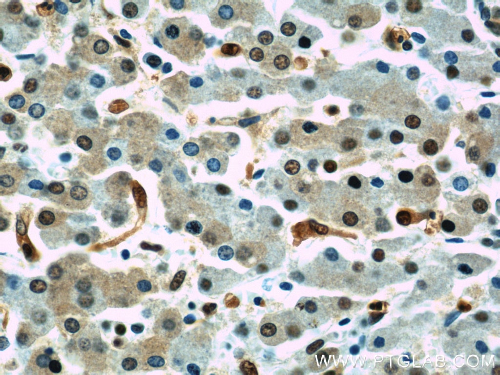 Immunohistochemistry (IHC) staining of human liver tissue using Transketolase Polyclonal antibody (11039-1-AP)