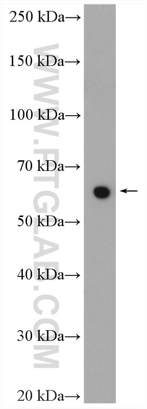 Western Blot (WB) analysis of rat liver tissue using Transketolase Polyclonal antibody (11039-1-AP)