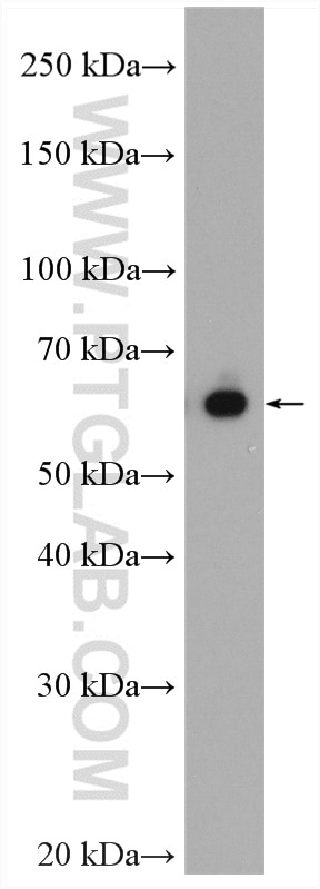 Western Blot (WB) analysis of Jurkat cells using Transketolase Polyclonal antibody (11039-1-AP)