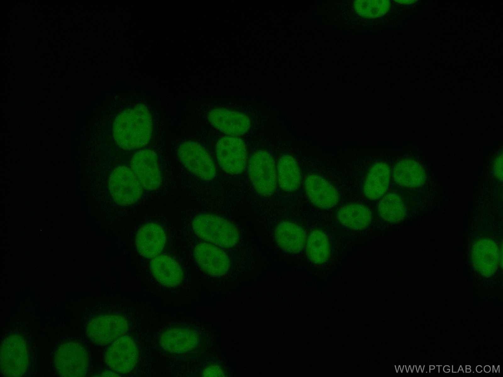 Immunofluorescence (IF) / fluorescent staining of HepG2 cells using Transketolase Monoclonal antibody (66016-1-Ig)