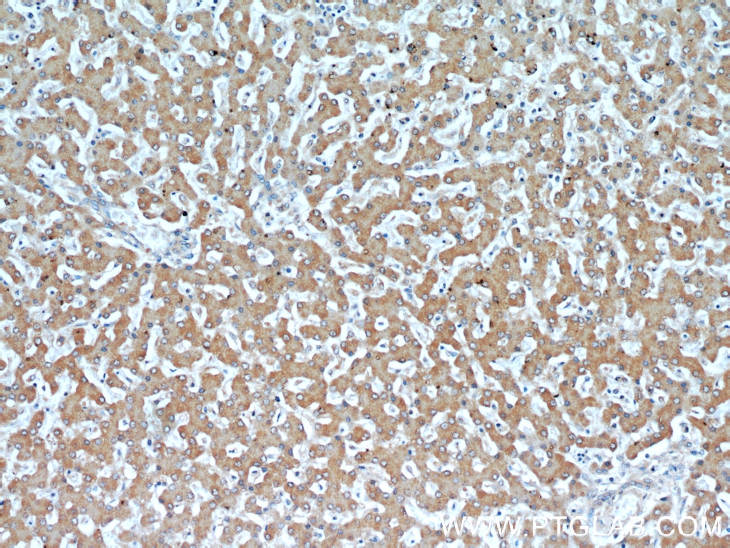 Immunohistochemistry (IHC) staining of human liver tissue using Transketolase Monoclonal antibody (66016-1-Ig)