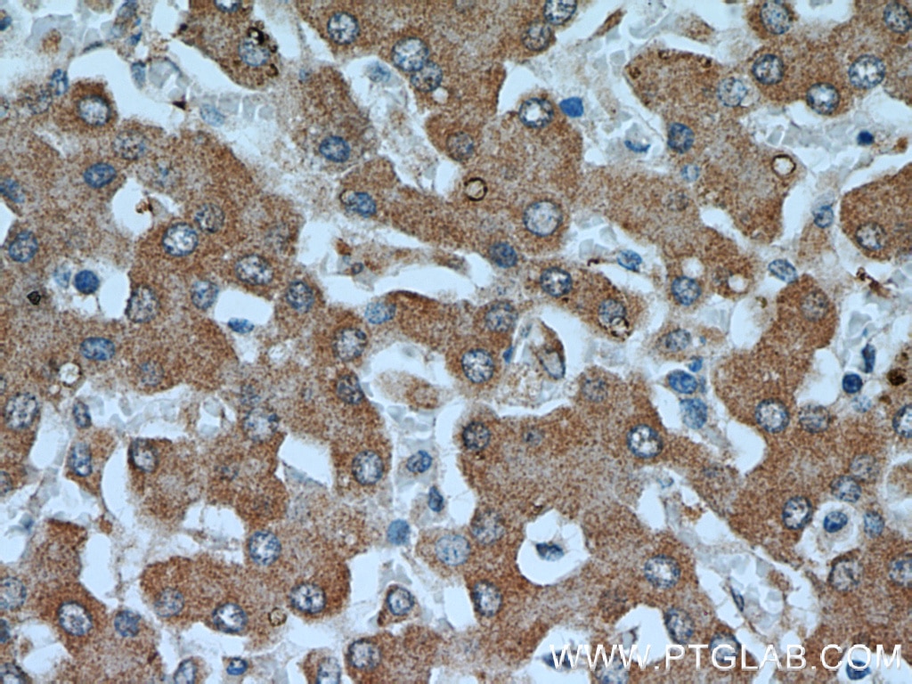 Immunohistochemistry (IHC) staining of human liver tissue using Transketolase Monoclonal antibody (66016-1-Ig)