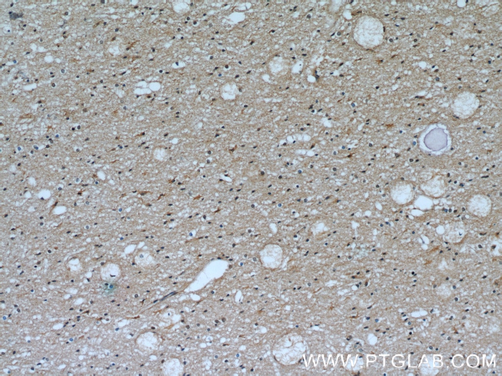 Immunohistochemistry (IHC) staining of human brain tissue using Transketolase Monoclonal antibody (66016-1-Ig)