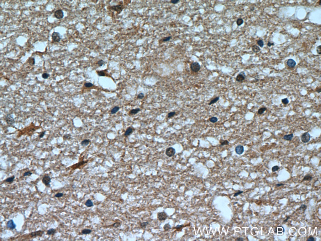 Immunohistochemistry (IHC) staining of human brain tissue using Transketolase Monoclonal antibody (66016-1-Ig)