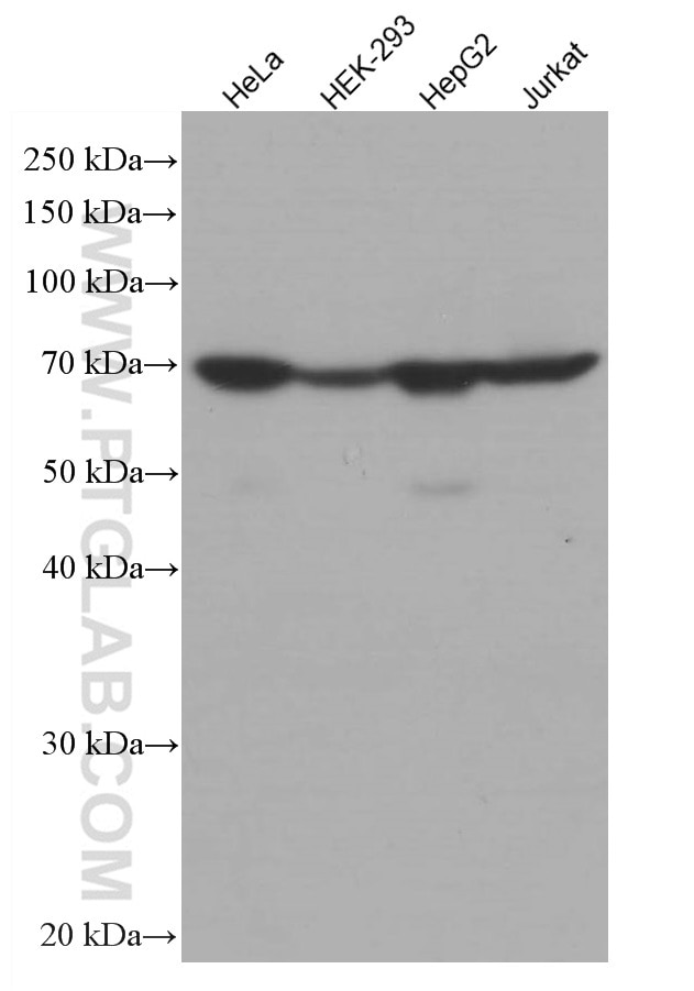 Western Blot (WB) analysis of various lysates using Transketolase Monoclonal antibody (66016-1-Ig)