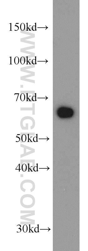 Western Blot (WB) analysis of HeLa cells using Transketolase Monoclonal antibody (66016-1-Ig)