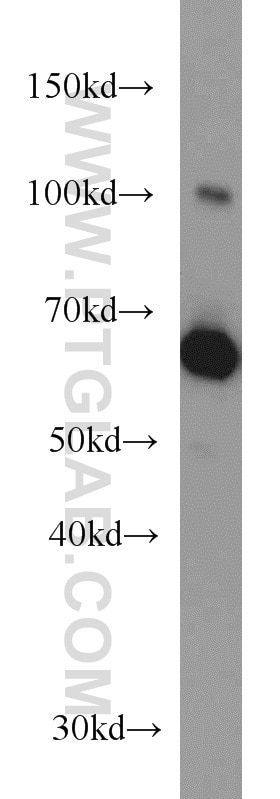 Western Blot (WB) analysis of HepG2 cells using Transketolase Monoclonal antibody (66016-1-Ig)