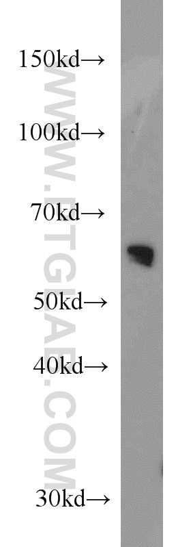 Western Blot (WB) analysis of human liver tissue using Transketolase Monoclonal antibody (66016-1-Ig)