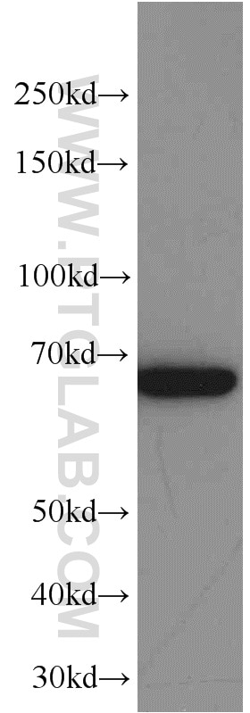 Western Blot (WB) analysis of Jurkat cells using Transketolase Monoclonal antibody (66016-1-Ig)