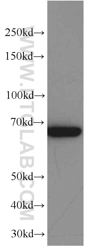 WB analysis of Jurkat using 66016-1-Ig