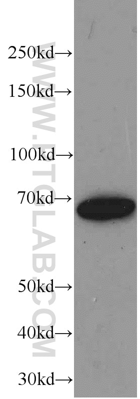 Western Blot (WB) analysis of human brain tissue using Transketolase Monoclonal antibody (66016-1-Ig)