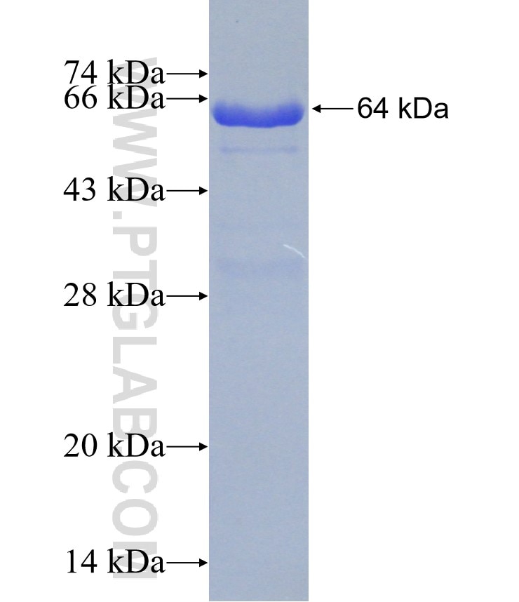 TKT fusion protein Ag1519 SDS-PAGE