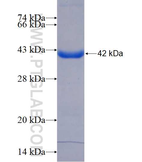 TKT fusion protein Ag16779 SDS-PAGE