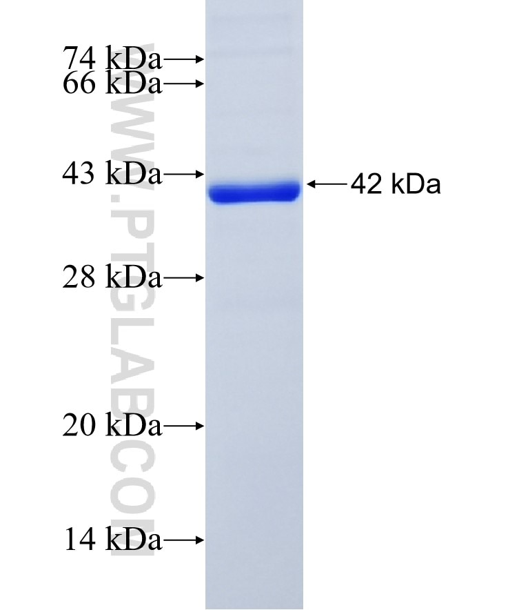 TKT fusion protein Ag16779 SDS-PAGE