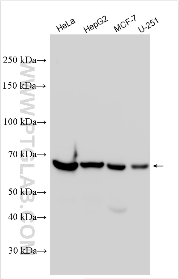 Western Blot (WB) analysis of various lysates using TKTL1 Polyclonal antibody (13819-1-AP)