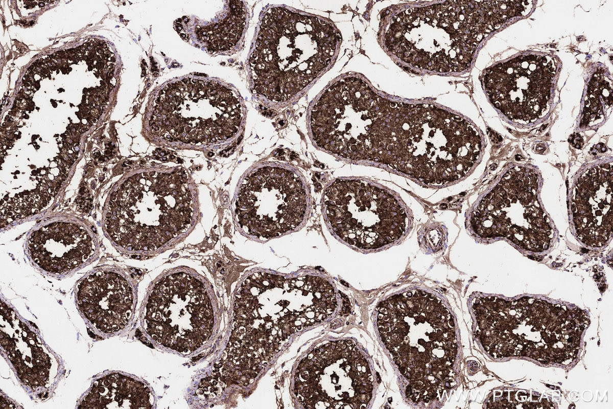Immunohistochemistry (IHC) staining of human testis tissue using TKTL1 Recombinant monoclonal antibody (85877-1-RR)
