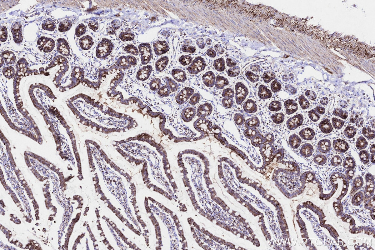 Immunohistochemistry (IHC) staining of rat small intestine tissue using TKTL1 Recombinant monoclonal antibody (85877-1-RR)