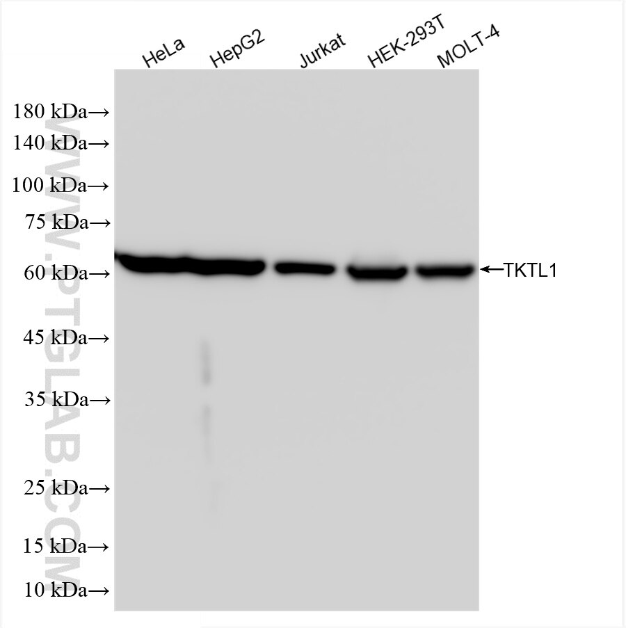 Western Blot (WB) analysis of various lysates using TKTL1 Recombinant antibody (85877-1-RR)