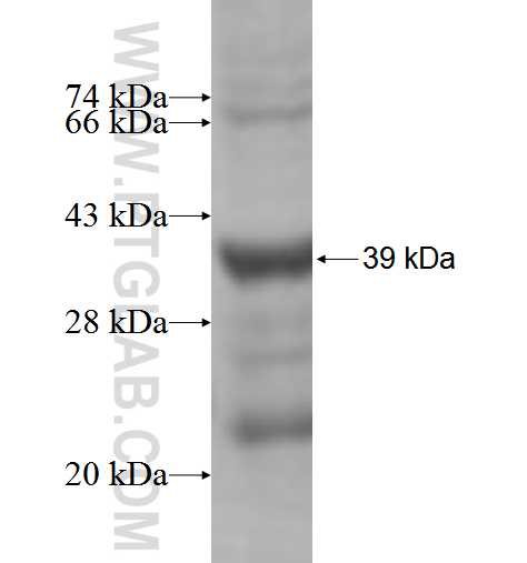 TKTL1 fusion protein Ag5148 SDS-PAGE