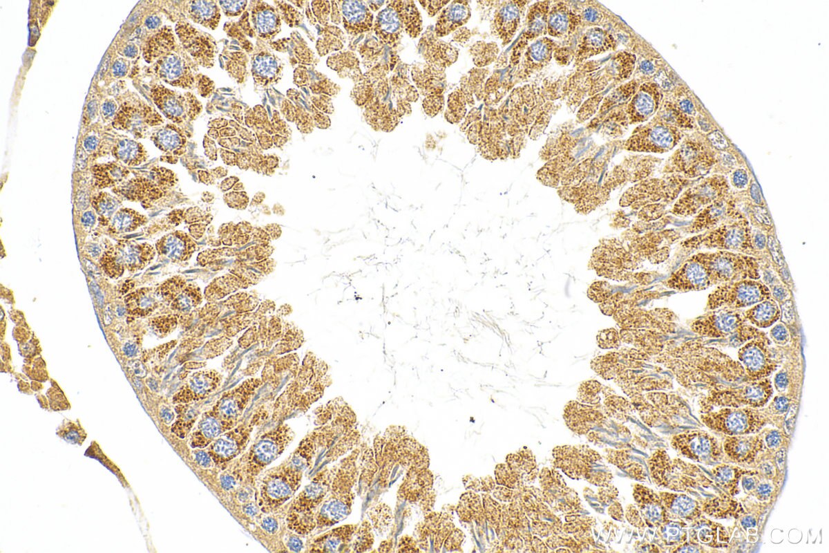 Immunohistochemistry (IHC) staining of rat testis tissue using TKTL2 Polyclonal antibody (17135-1-AP)
