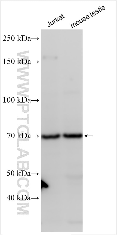 Western Blot (WB) analysis of various lysates using TKTL2 Polyclonal antibody (17135-1-AP)