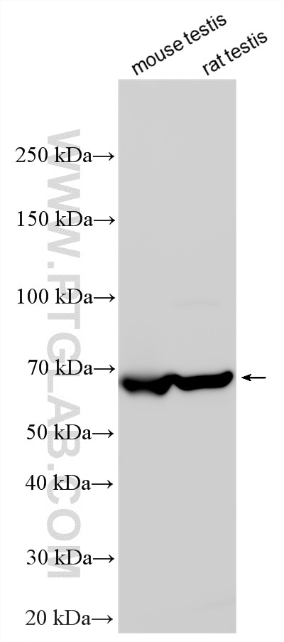WB analysis using 17135-1-AP (same clone as 17135-1-PBS) Western Blot (WB) analysis of various lysates using TKTL2 Polyclonal antibody (17135-1-AP)
