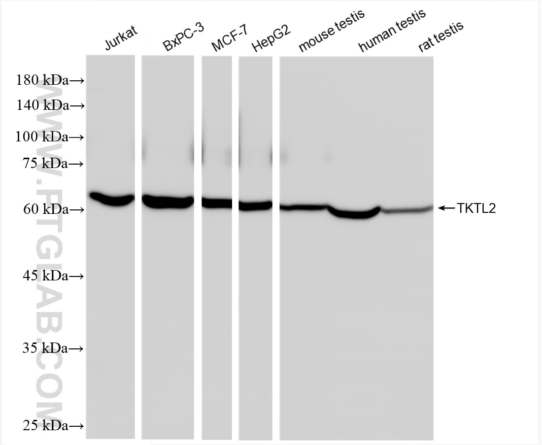 Western Blot (WB) analysis of various lysates using TKTL2 Recombinant antibody (85612-3-RR)