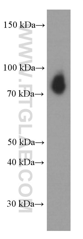 Western Blot (WB) analysis of Jurkat cells using TLE1 Monoclonal antibody (66216-1-Ig)