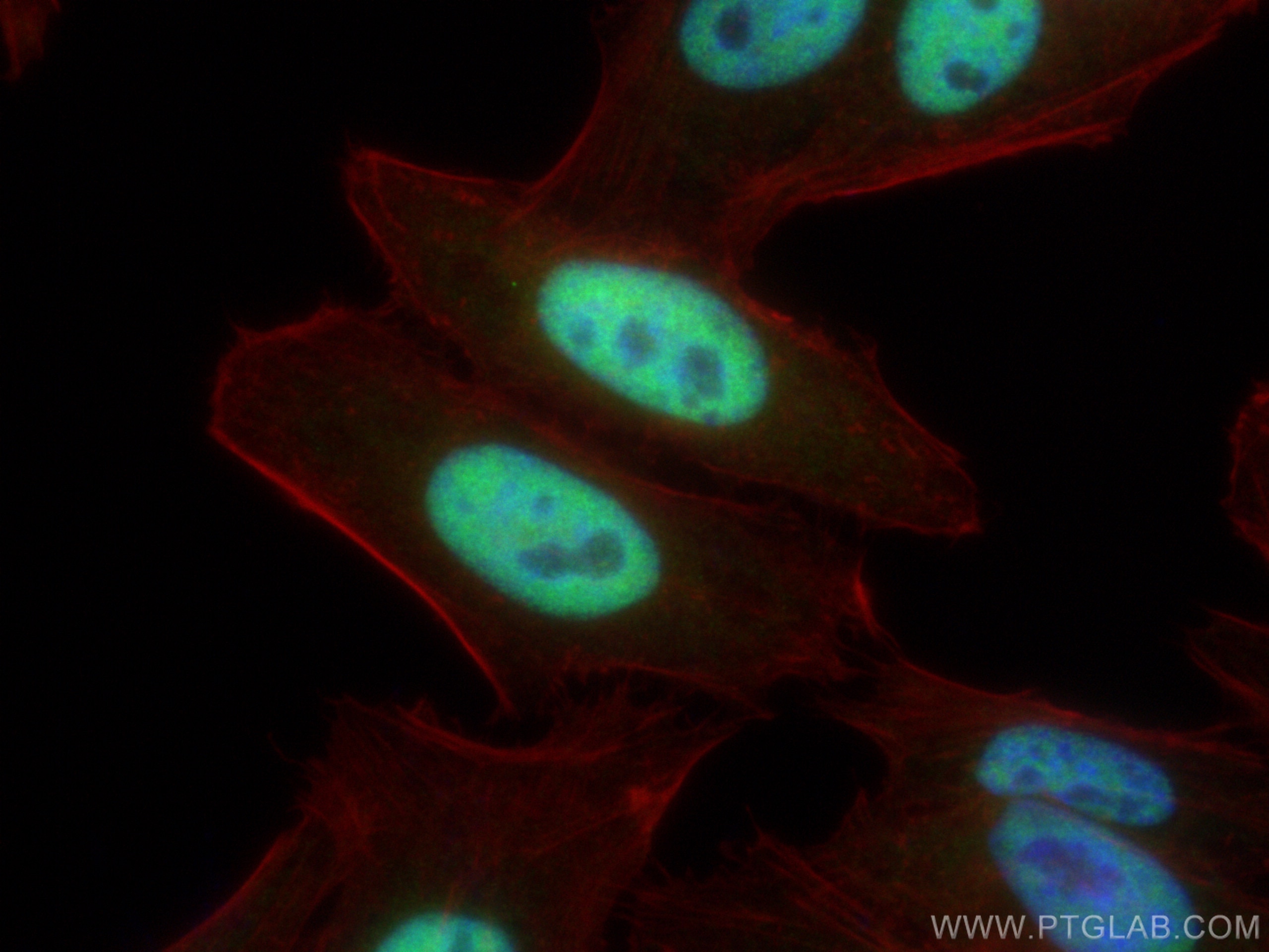 IF Staining of HepG2 using 11372-1-AP