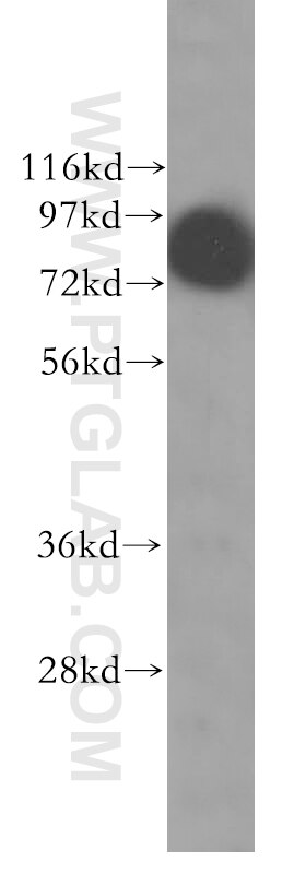 Western Blot (WB) analysis of HeLa cells using TLE3 Polyclonal antibody (11372-1-AP)