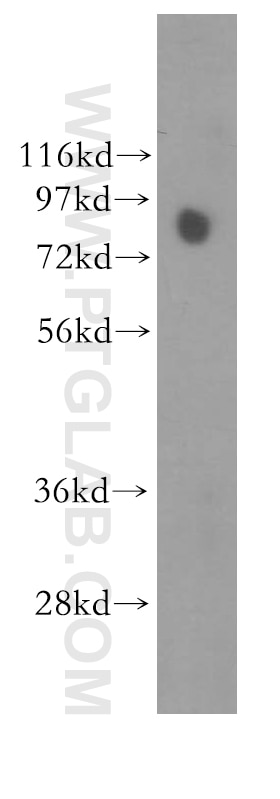 Western Blot (WB) analysis of human lung tissue using TLE3 Polyclonal antibody (11372-1-AP)