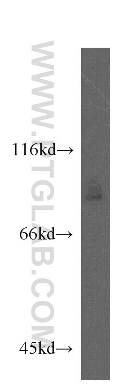 Western Blot (WB) analysis of HeLa cells using TLE3 Polyclonal antibody (11372-1-AP)