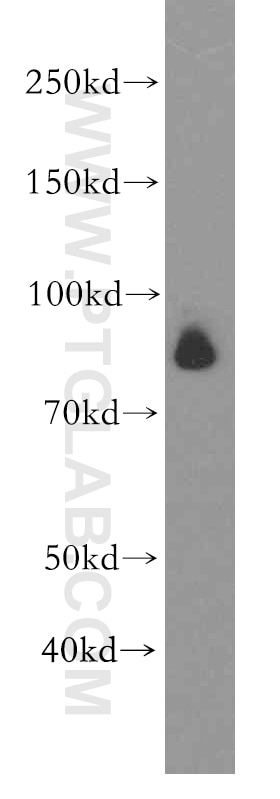 Western Blot (WB) analysis of HeLa cells using TLE3 Polyclonal antibody (11372-1-AP)