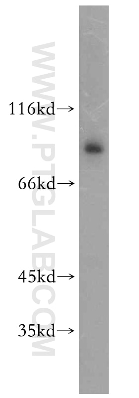 Western Blot (WB) analysis of HepG2 cells using TLE3 Polyclonal antibody (11372-1-AP)