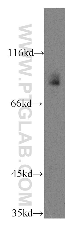 Western Blot (WB) analysis of HeLa cells using TLE3 Polyclonal antibody (11372-1-AP)