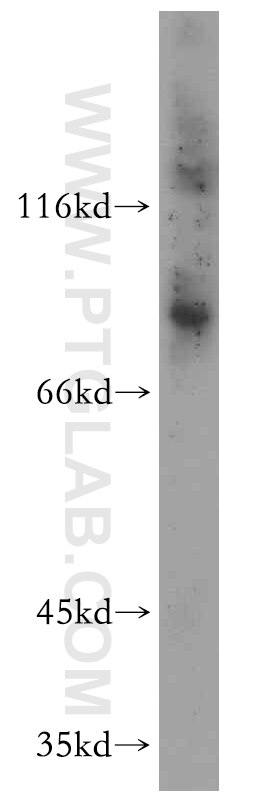 Western Blot (WB) analysis of A431 cells using TLE3 Polyclonal antibody (11372-1-AP)
