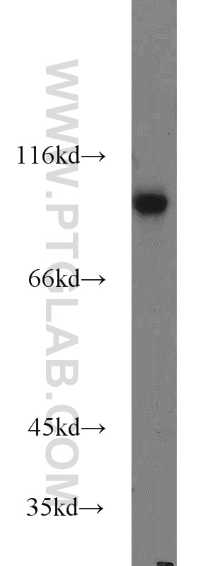 Western Blot (WB) analysis of A431 cells using TLE3 Polyclonal antibody (22094-1-AP)