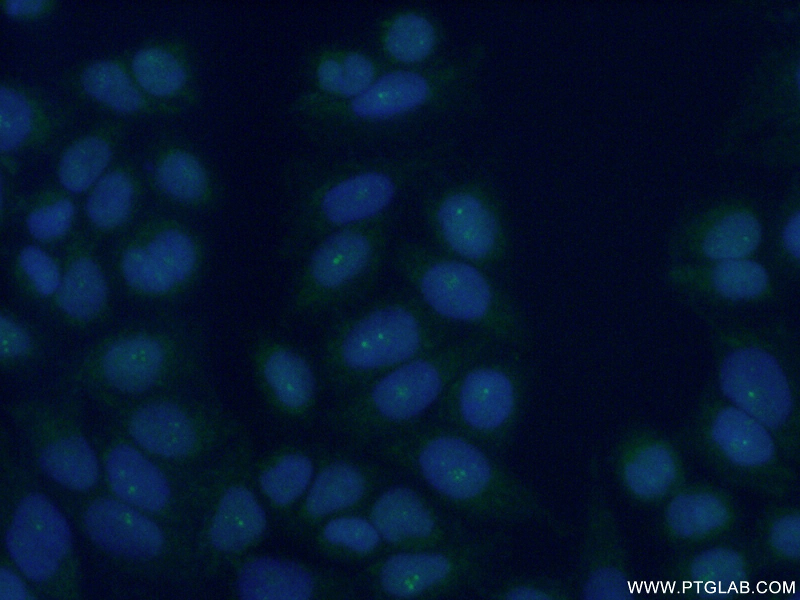 Immunofluorescence (IF) / fluorescent staining of HeLa cells using TLK1 Polyclonal antibody (13564-1-AP)