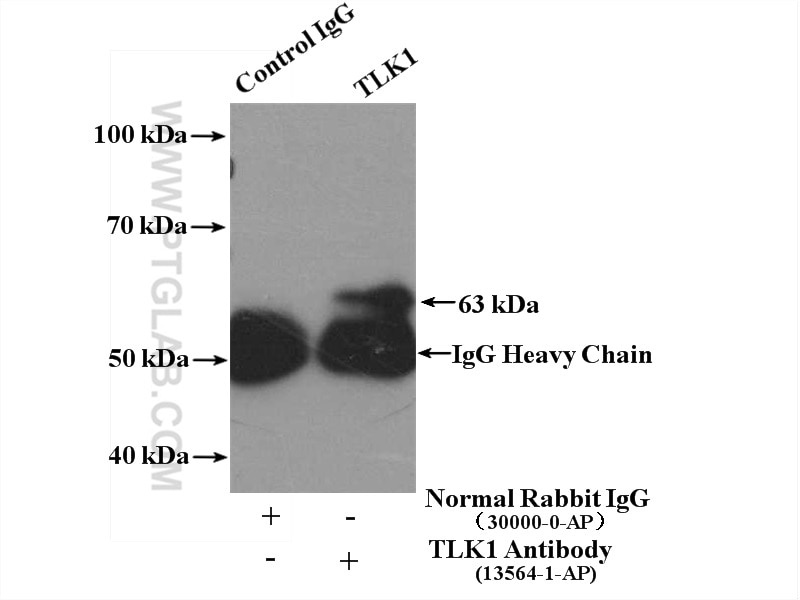 Immunoprecipitation (IP) experiment of HeLa cells using TLK1 Polyclonal antibody (13564-1-AP)