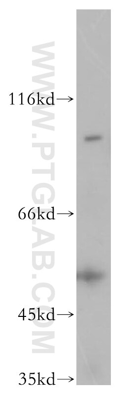 Western Blot (WB) analysis of HeLa cells using TLK1 Polyclonal antibody (13564-1-AP)