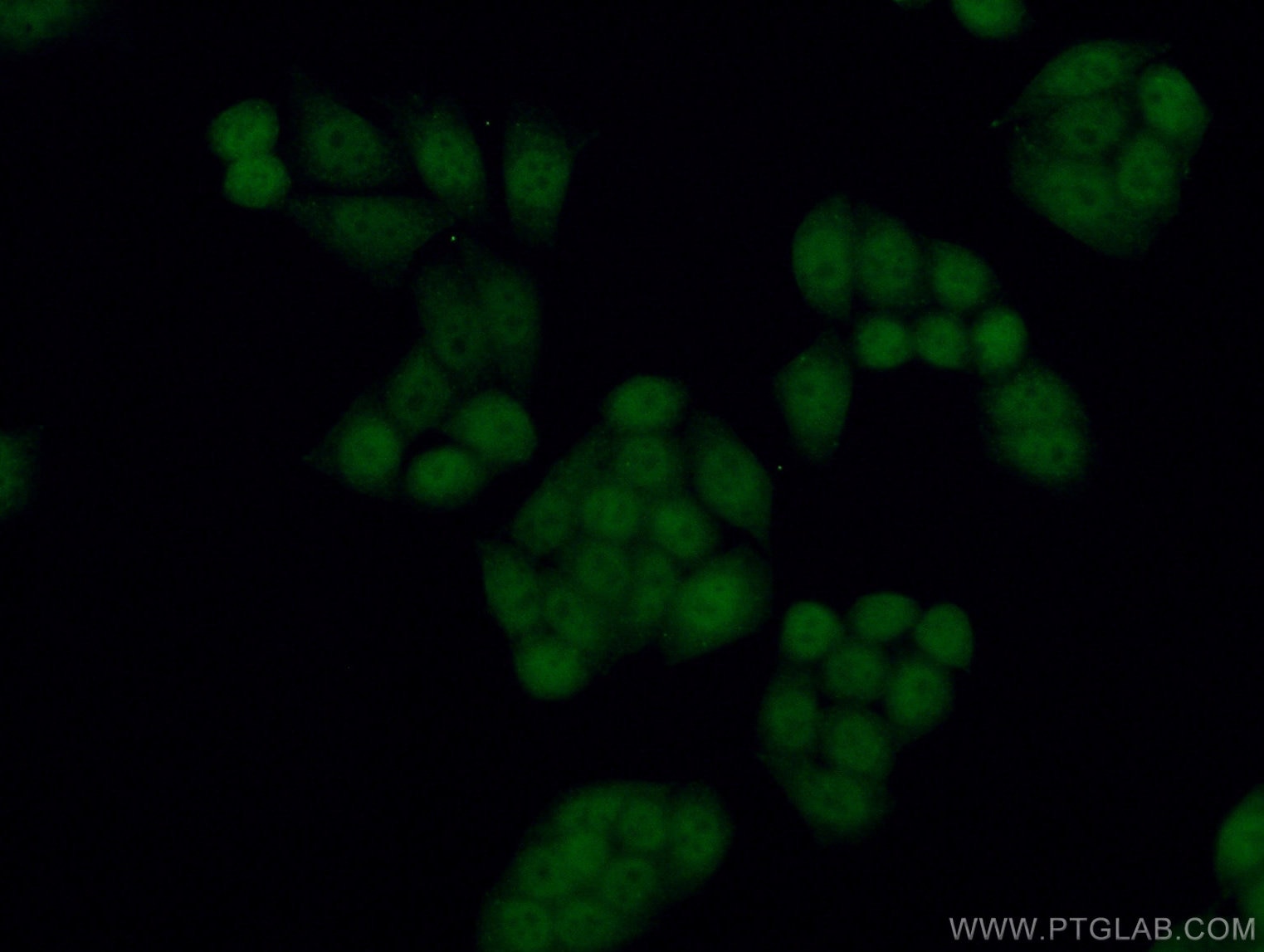 Immunofluorescence (IF) / fluorescent staining of HeLa cells using TLK2 Polyclonal antibody (13979-1-AP)
