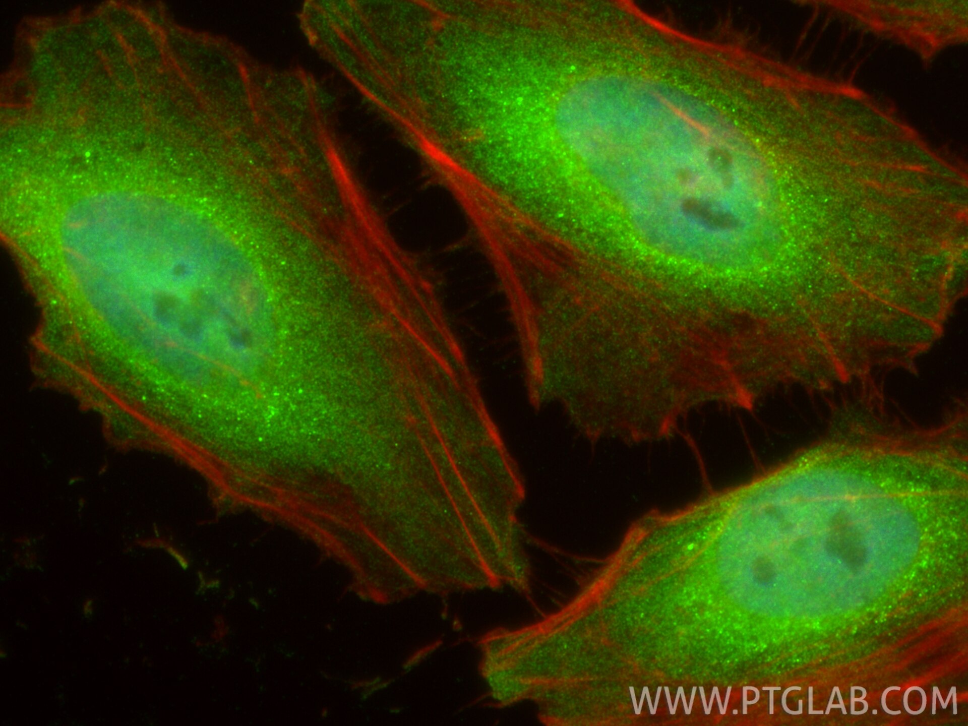 Immunofluorescence (IF) / fluorescent staining of HeLa cells using TLK2 Polyclonal antibody (13979-1-AP)