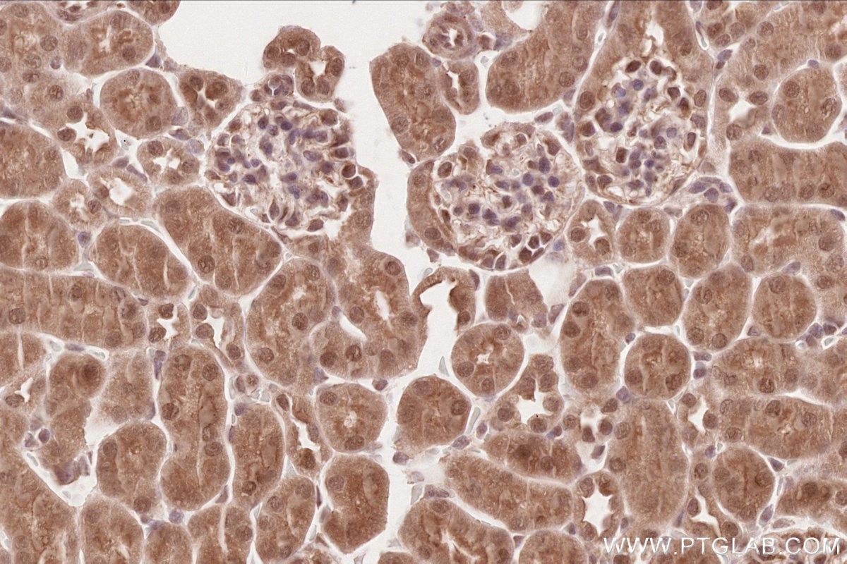 Immunohistochemistry (IHC) staining of mouse kidney tissue using TLK2 Polyclonal antibody (13979-1-AP)