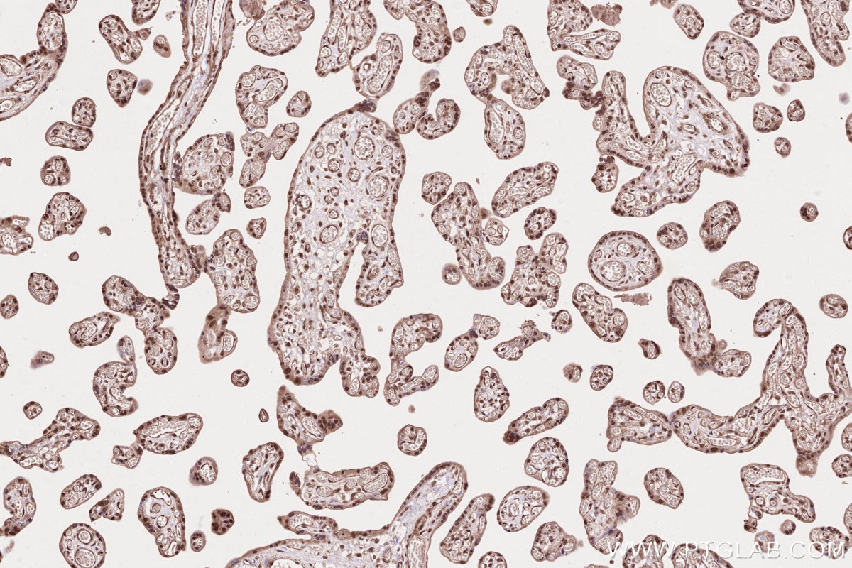 Immunohistochemistry (IHC) staining of human placenta tissue using TLK2 Polyclonal antibody (13979-1-AP)