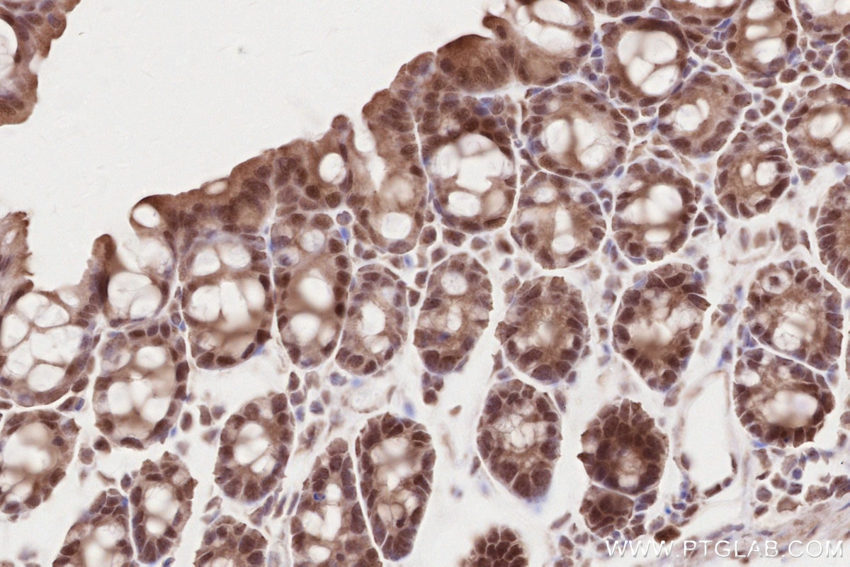 Immunohistochemistry (IHC) staining of mouse colon tissue using TLK2 Polyclonal antibody (13979-1-AP)