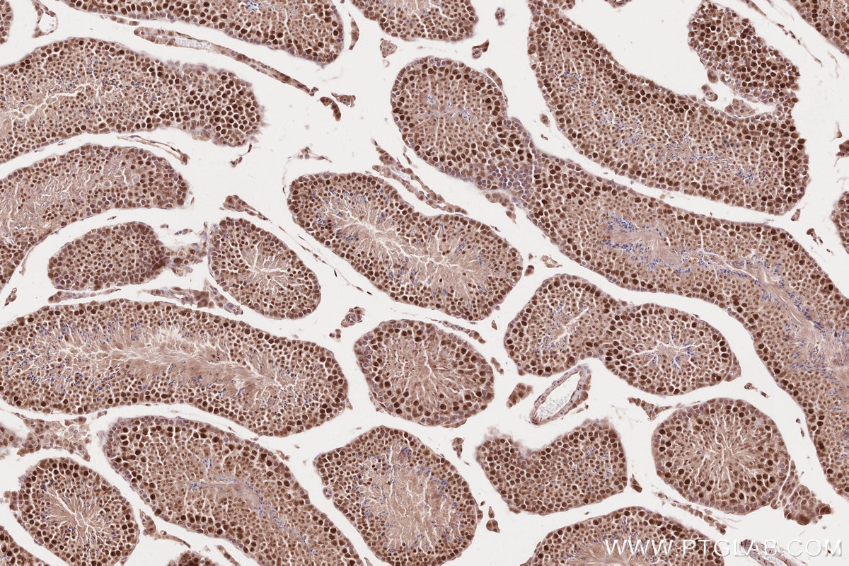 Immunohistochemistry (IHC) staining of mouse testis tissue using TLK2 Polyclonal antibody (13979-1-AP)