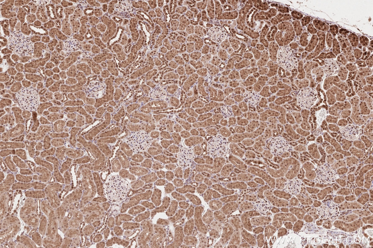 Immunohistochemistry (IHC) staining of rat kidney tissue using TLK2 Polyclonal antibody (13979-1-AP)