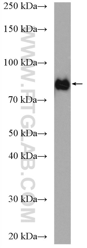 Western Blot (WB) analysis of MCF-7 cells using TLK2 Polyclonal antibody (13979-1-AP)