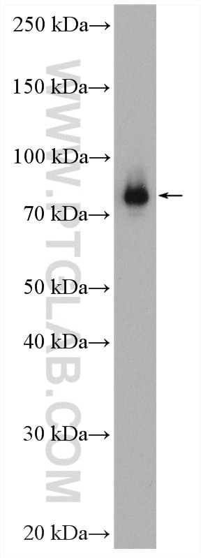 Western Blot (WB) analysis of HeLa cells using TLK2 Polyclonal antibody (13979-1-AP)