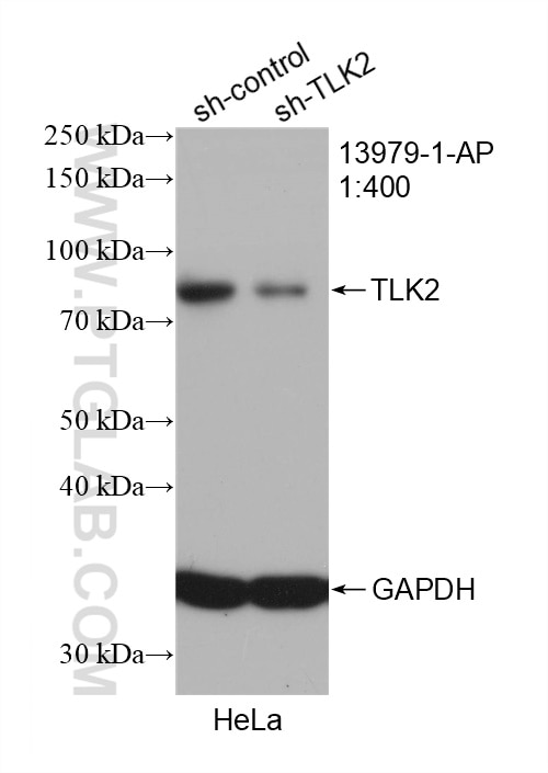 Western Blot (WB) analysis of HeLa cells using TLK2 Polyclonal antibody (13979-1-AP)